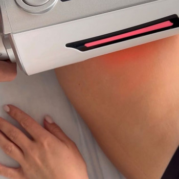 Luir Laser, Рівне Фото - 5