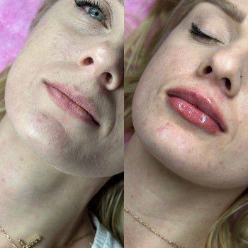 Руслана Мицней, Черновцы Фото - 4