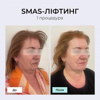 TK Laser, Івано-Франківськ Фото - 2