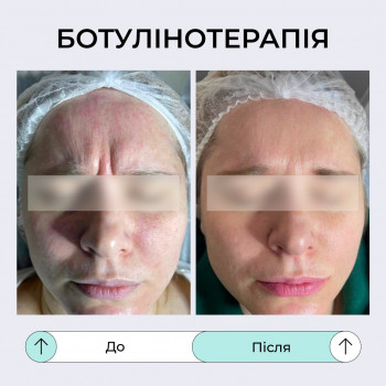 TK Laser, Івано-Франківськ Фото - 10