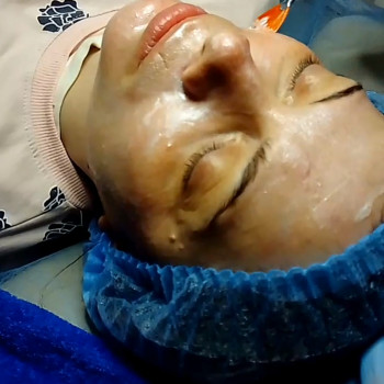 Фотосесія косметолог пілінг косметологльвів косметологіяцентр, фото - косметолог Наталя Щутяк