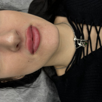 Збільшення губ
                    Стоматолог Ирина Луцк