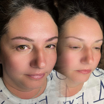 Волоскова реконструкція брів
                    Мастер перманентного макияжа Олеся Киев