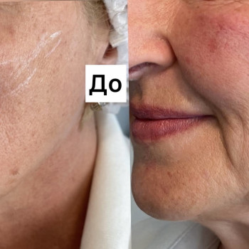 Фото з портфоліо фахівця Ирина Дячук (стоматолог, Луцьк)