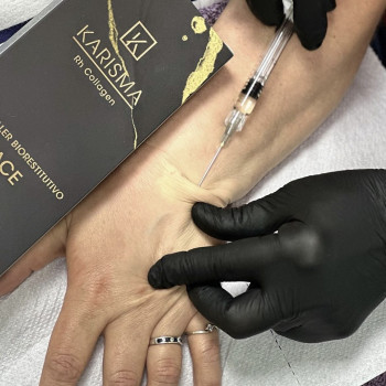 Фото з портфоліо фахівця Ирина Дячук (стоматолог, Луцьк)