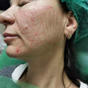 Фото з портфоліо фахівця Ирина Дячук (стоматолог, Луцьк)