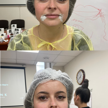 Фото з портфоліо фахівця Ирина Дячук (стоматолог, Луцьк)