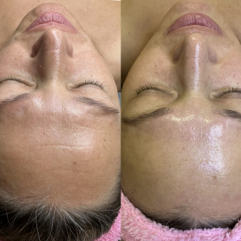 Массаж обличчя, пілінг та чистка обличчя.