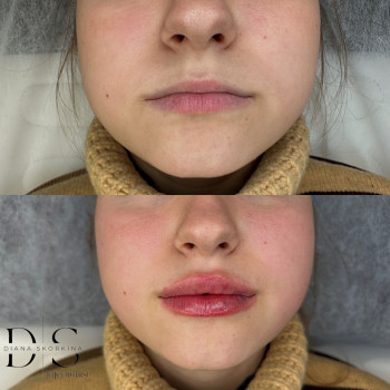 Диана Скоркина, Харьков Фото - 38