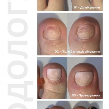 Наталья Косицкая, Киев Фото - 7