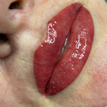 Анна Варакута, Кропивницький Фото - 13