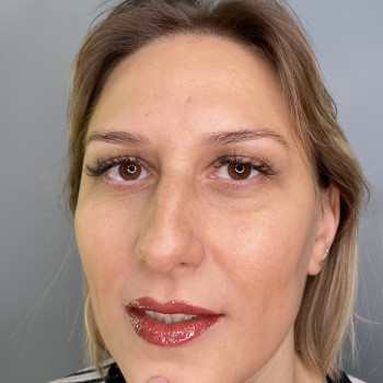 Анна Варакута, Кропивницький Фото - 20