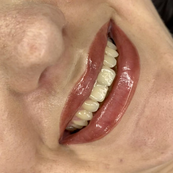 Анна Варакута, Кропивницький Фото - 33