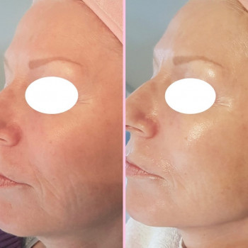 Skin Lounge, Тернопіль Фото - 5