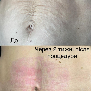 Наталья Забояк, Тернополь Фото - 5