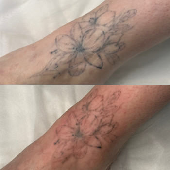 Laser Boutique, Тернопіль Фото - 5