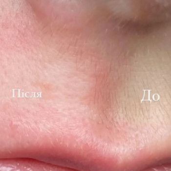 Electro, Тернопіль Фото - 5