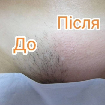 Любов , Луцьк Фото - 5