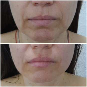 Результат однієї процедури