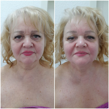 Результат однієї процедури