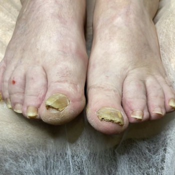 Подологія SUDA. Нігтьовий сервіс, Харьков Фото - 11