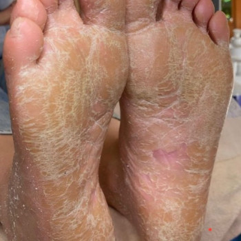 Подологія SUDA. Нігтьовий сервіс, Харьков Фото - 14