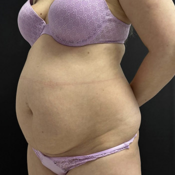 Абдель Эрритали, Харків Фото - 36