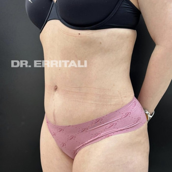 Абдель Эрритали, Харків Фото - 37