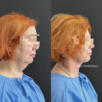 Абдель Эрритали, Харків Фото - 44