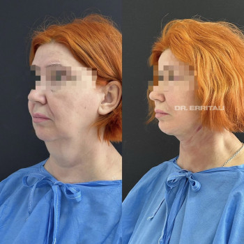 Абдель Эрритали, Харків Фото - 45