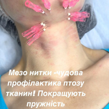 Алла Антонюк, Київ Фото - 6