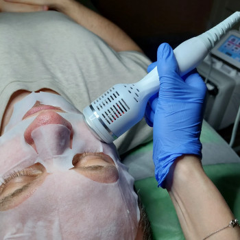 Фракционная микроигольчатая мезотерапия
                    Косметолог-эстетист Марина Одесса