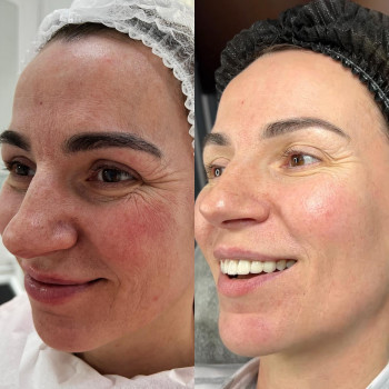 Антоніна Джулай, Київ Фото - 5