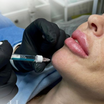 Ірина Оліфер, Київ Фото - 6