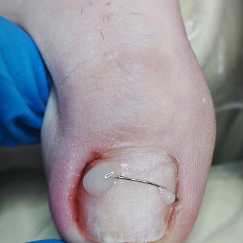 Podo-center "TATS" by Tetiana Tsyhulska, Кропивницкий Фото - 38