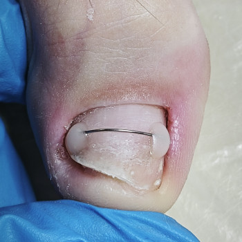 Podo-center "TATS" by Tetiana Tsyhulska, Кропивницкий Фото - 30