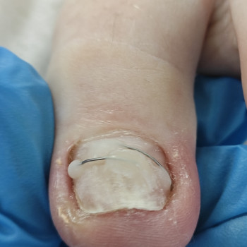 Podo-center "TATS" by Tetiana Tsyhulska, Кропивницкий Фото - 32