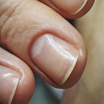 Podo-center "TATS" by Tetiana Tsyhulska, Кропивницкий Фото - 23