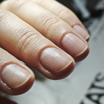 Podo-center "TATS" by Tetiana Tsyhulska, Кропивницкий Фото - 25