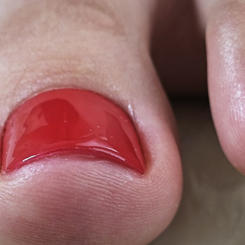 Podo-center "TATS" by Tetiana Tsyhulska, Кропивницкий Фото - 13