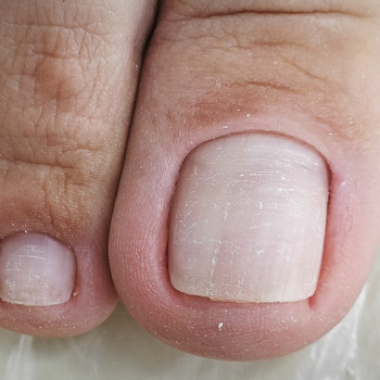 Podo-center "TATS" by Tetiana Tsyhulska, Кропивницкий Фото - 15