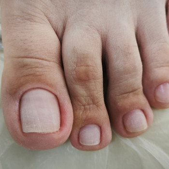 Podo-center "TATS" by Tetiana Tsyhulska, Кропивницкий Фото - 16