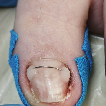 Podo-center "TATS" by Tetiana Tsyhulska, Кропивницкий Фото - 20