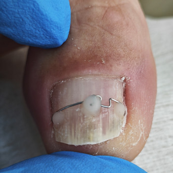 Podo-center "TATS" by Tetiana Tsyhulska, Кропивницкий Фото - 4