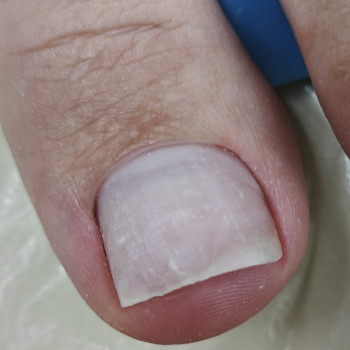 Podo-center "TATS" by Tetiana Tsyhulska, Кропивницкий Фото - 6