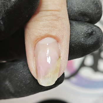 Podo-center "TATS" by Tetiana Tsyhulska, Кропивницкий Фото - 12