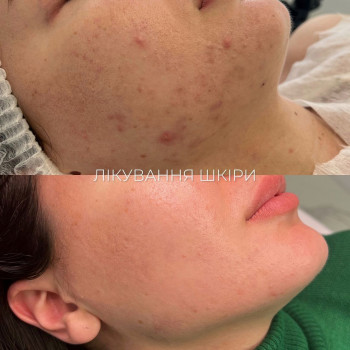 Лоліта , Київ Фото - 5