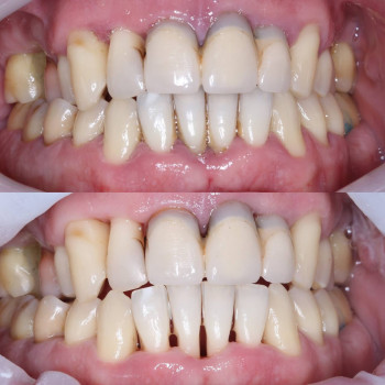 Лікар Аліна Анатоліївна,після пародонтологічного лікування в стоматології VA Clinic.