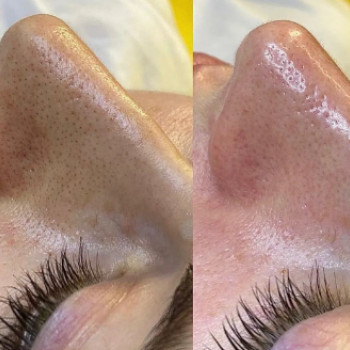 Наталія Шевчук, Київ Фото - 5