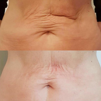 Юлия Мартиненко, Киев Фото - 5